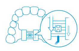 Expander Instructions